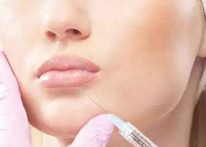 徐占鋒雙眼皮術(shù)后效果如何？專業(yè)醫(yī)生簡介及真實(shí)案例分享