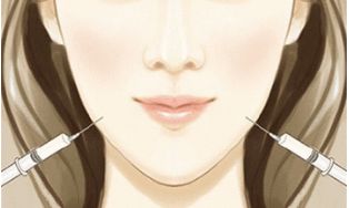 重慶醫(yī)科大學(xué)附屬第一醫(yī)院小蠻腰：雙眼皮手術(shù)無(wú)痛、自然、效果好