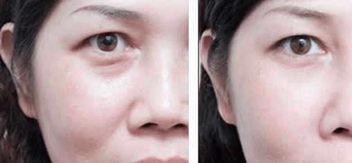 上海治療疤痕的醫(yī)院排名出爐！五家專業(yè)醫(yī)院實(shí)力震撼，趕快了解！