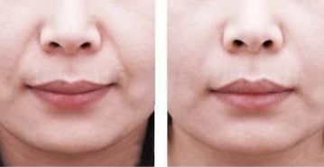 2023年南京熱門提升年輕外貌的知名醫(yī)師排行榜，更新當(dāng)?shù)貍涫苜澴u的專家醫(yī)生推薦詳細信息一覽