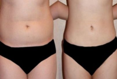 杭州哪家醫(yī)院是顴骨內(nèi)推領(lǐng)域的知名品牌？頂級醫(yī)院排行榜：浙江第一，浙江第二等梳理為參考