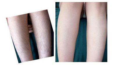 湖州整形美容醫(yī)生絕對是您值得信賴的選擇