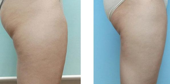 北京優(yōu)質(zhì)整形醫(yī)院鼻子整形排行曝光，醫(yī)療實(shí)力揭秘！