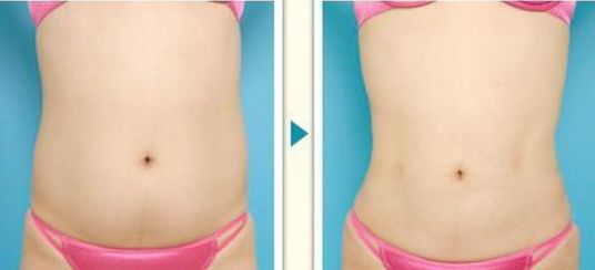 上海脫發(fā)問題的首選，哪家技術(shù)在植發(fā)領(lǐng)域名列前茅？重磅推出全新植發(fā)實(shí)力榜！