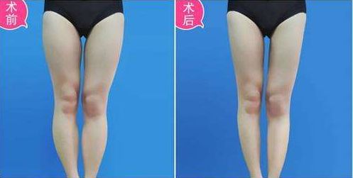 武漢哪家醫(yī)療機構(gòu)在正畸美容領(lǐng)域聲名顯赫？中山、美萊為佼佼者！