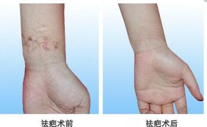 北京自體脂肪隆胸專家真實(shí)排行，專業(yè)技術(shù)精粹一同分享