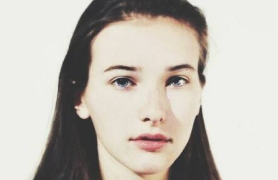 上海九院名醫(yī)許志成幫您輕松解決眼袋問(wèn)題，真實(shí)案例告訴您效果如何！