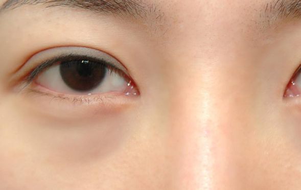 寧波臉部整形領(lǐng)域翹楚！頂尖雙眼皮醫(yī)生大揭秘