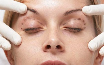 名醫(yī)徐增亮帶你解讀瑞芙臣祛痘技術(shù)，真實(shí)案例和價(jià)格信息全揭秘！