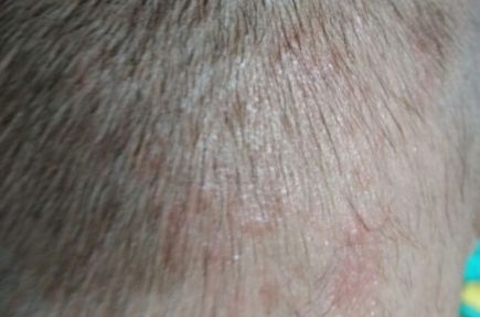 銀川奧蕊斯整形醫(yī)院震驚！驚艷面容煥然一新案例披露