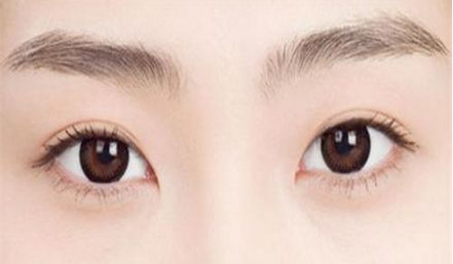 上海九院董繼英醫(yī)生隆鼻案例分享，讓你探尋玻尿酸隆鼻效果如何