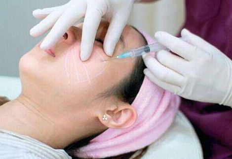 上海長(zhǎng)海醫(yī)院宋建星醫(yī)生：雙眼皮手術(shù)新體驗(yàn)，成功案例分享