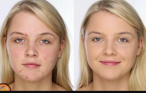 寧德醫(yī)美整形醫(yī)院哪家口碑比較好？雙眼皮價(jià)格查詢(xún)后的綜合評(píng)價(jià)如何？