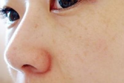 蘭州大學(xué)第二醫(yī)院私密整形部門案例揭示，充滿驚喜！