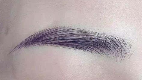 武漢市一醫(yī)院整形科值得信賴嗎？有人親自體驗過熱瑪吉恢復(fù)過程嗎？