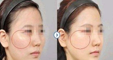 南京明星雙眼皮修復(fù)醫(yī)生排行榜2023，黃金龍、劉育鳳等著名專家入選！