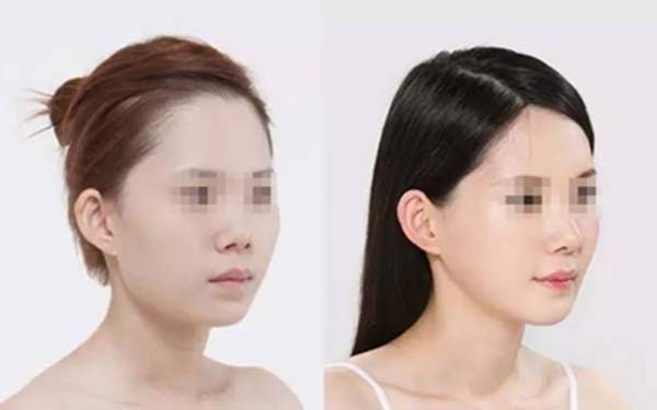 貴州六盤水吳氏嘉美整形醫(yī)院是口碑不錯(cuò)嗎？如何一鍵獲取醫(yī)院口碑？