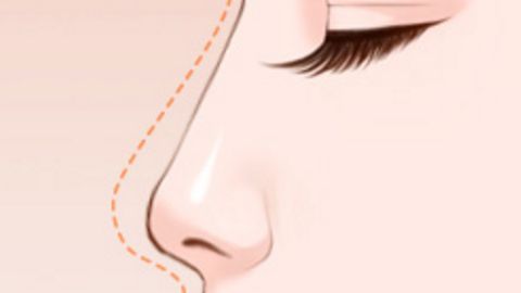 國(guó)內(nèi)整容醫(yī)院哪家值得信賴？面部吸脂推薦選這幾家！公立和私立醫(yī)美機(jī)構(gòu)實(shí)力強(qiáng)勁！