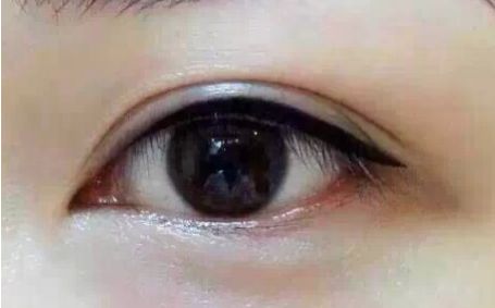 2023年四川明星雙眼皮專家全球發(fā)布丨郭祥文、郭波、肖海濤top5醫(yī)師介紹