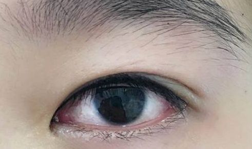 上海整形界最受歡迎的吸脂專家推薦，李耐國、曹衛(wèi)剛、李發(fā)成等醫(yī)生備受贊譽(yù)！附真實(shí)案例供參考