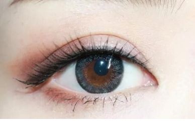 石家莊專家何靜雙眼皮技術(shù)如何？真人案例揭秘雙眼皮效果