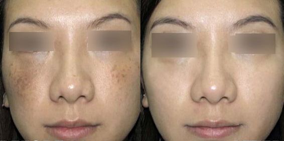 揭秘南京鼻王身份！專家盛贊前五強(qiáng)醫(yī)生，引人入勝！