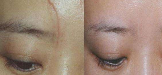 北京隆鼻哪里做得好？美容大夫們看好的三家醫(yī)院參考