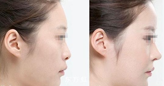 蘇州無線頻率融脂?？漆t(yī)生排名前十這幾位醫(yī)術(shù)聲譽超卓的醫(yī)生是您的不二之選