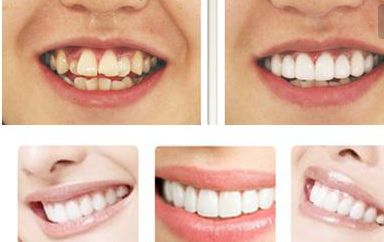 哪位醫(yī)生在北京最擅長鼻修復(fù)？不得不提的鼻整形專家！