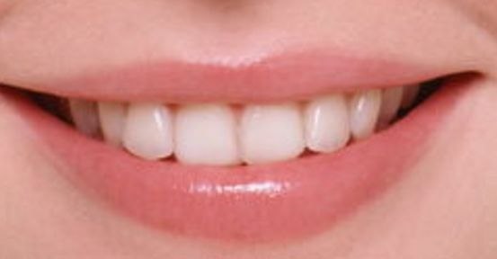 鄭州假體隆胸權(quán)威醫(yī)生推薦名單，值得信賴的選擇