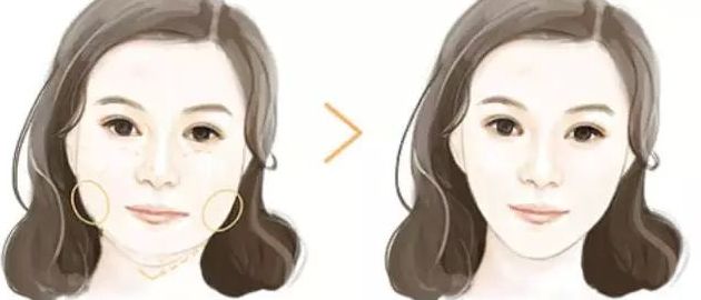 北京黎星醫(yī)生的面部脂肪填充效果如何？真實(shí)案例揭秘！