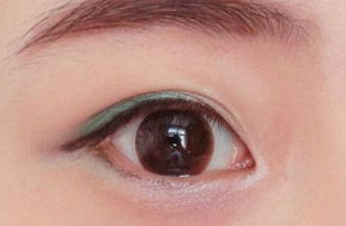 【曝光！杭州賈明醫(yī)生成功塑造雙眼皮案例，診所坐診時刻表公開】