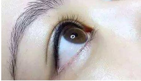 長沙哪位醫(yī)生在雙眼皮修復技術上口碑好找排名靠前的？