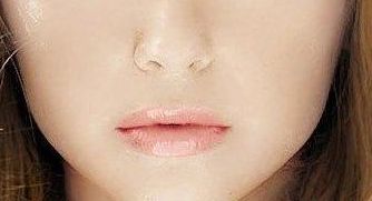 王維九院的雙眼皮修復技術值得信賴嗎？專家實力與成功案例給出參考