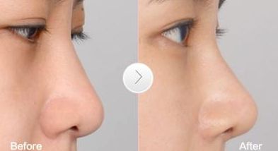 高效祛疤地，推薦的整形醫(yī)院在廣州！更有名口碑榜單盤點