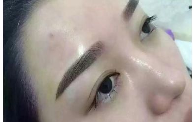 山西二院整形科的醫(yī)生名單更新及熱門項目價格表分享