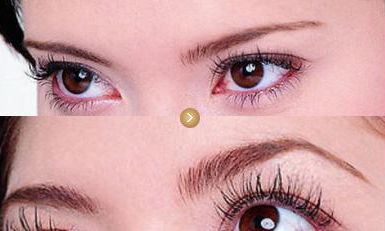 上海眼袋手術(shù)有哪些醫(yī)院推薦？這些醫(yī)療機(jī)構(gòu)醫(yī)術(shù)高超！