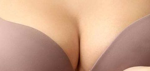 上海美萊診所-專家技術(shù)綜合評(píng)析及隆胸案例分享