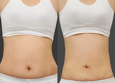 遼陽市整形美容院TOP10排行榜單公布！快來挑選適合你的醫(yī)院！