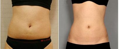 錦州美容整形科專家介紹及收費(fèi)明細(xì)表完善！