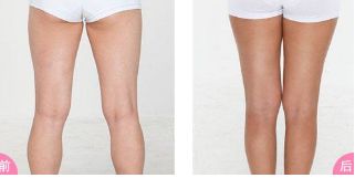 鄭州修復(fù)雙眼皮的專家推薦！這些醫(yī)院排名靠前、信譽有保障