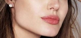 鄭州趙絳波卓越案例揭示——手術(shù)成功后煥然一新！