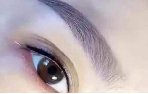 廣州治療內(nèi)眼角凹陷，選擇這幾家醫(yī)院最靠譜