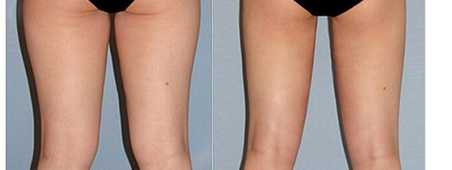 溧陽市眼科專家就診推薦，醫(yī)生名單及治療費(fèi)用一覽