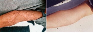 遼寧省近視治療醫(yī)院五佳榜單，這幾家醫(yī)院翹楚地位！