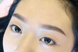 如何優(yōu)雅地?fù)碛须p眼皮？了解專家經(jīng)驗(yàn)與最新案例！