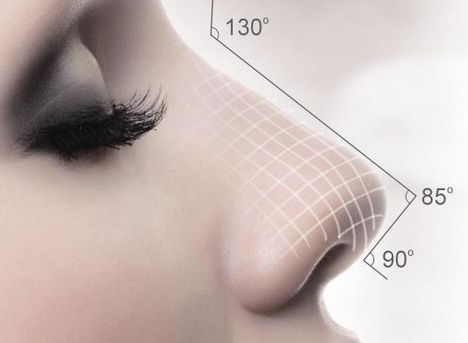 新鳴醫(yī)生：雙眼皮修復(fù)案例揭秘，分享給大家！