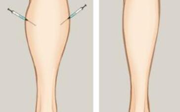 鄭州天后醫(yī)療美容醫(yī)院有哪些病例分享？