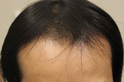 復(fù)旦大學(xué)附屬華山醫(yī)院是否提供整形手術(shù)服務(wù)？整形費(fèi)用如何？有哪些口碑醫(yī)生可供選擇？