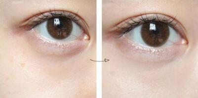 滄州隆鼻有哪些醫(yī)院可以做？如何選擇適合自己的醫(yī)院